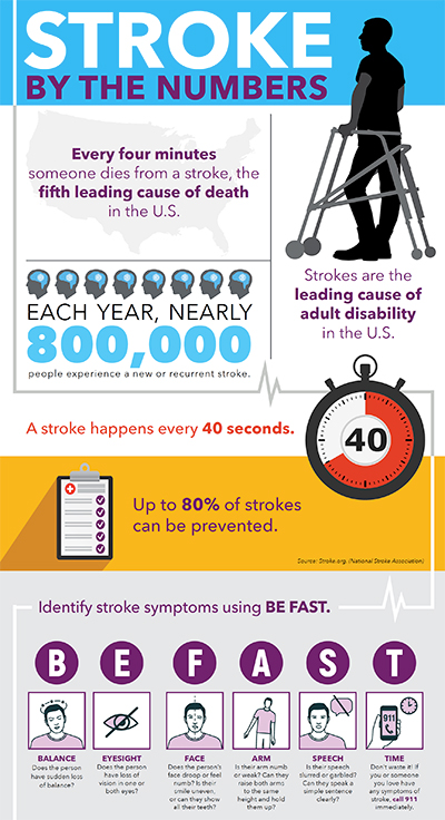 Stroke by the numbers - click for the full infographic