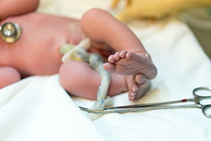 How to Care for Your Newborn's Umbilical Cord Stump, Methodist Health  System